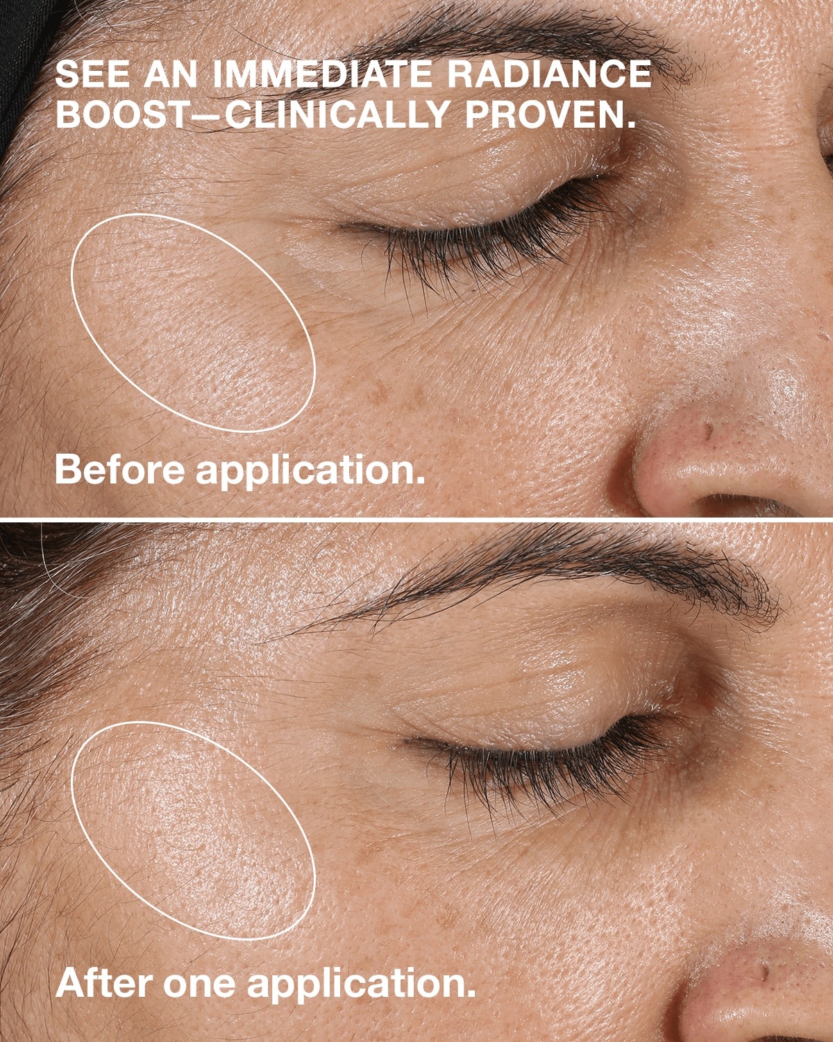 Clinique - Clinique Clarifying Lotion 2 - Exfoliator for Dry Skin - Clinique Clinique Clarifying Lotion 2 - Exfoliator for Dry Skin EXprimi Skincare Kenya - EXprimi Skincare Kenya - #product_page_title#