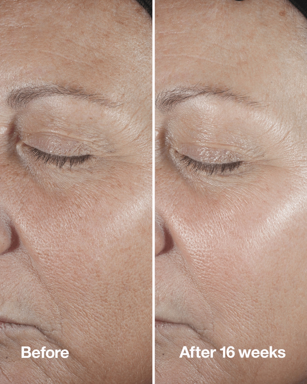 Clinique Smart Clinical Repair™ Wrinkle Correcting Serum | Clinique 30ml EXprimi Skincare Kenya