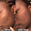 Good Molecules Discoloration Correcting Serum Serum GoodMolecules-DiscolorationCorrectingSerum-GoodMoleculesDiscolorationCorrectingSerumEXprimiSkincareKenya-Serum-EXprimiSkincareKenya-8100196105476 shop at Exprimi Beauty Kenya. Home of Skin care, Body care, Make-up, Fragrance & Beauty.
