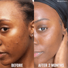Good Molecules Discoloration Correcting Serum Serum GoodMolecules-DiscolorationCorrectingSerum-GoodMoleculesDiscolorationCorrectingSerumEXprimiSkincareKenya-Serum-EXprimiSkincareKenya-8100196105477 shop at Exprimi Beauty Kenya. Home of Skin care, Body care, Make-up, Fragrance & Beauty.