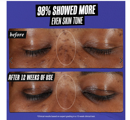 Kiehl's Since 1851 Clearly Corrective™ Dark Spot Correcting Serum with Vitamin C Dark Spot Corrector Kiehl_s_Since_1851_Clearly_Corrective_Dark_Spot_Correcting_Serum_with_Vitamin_C_EXprimi_Beauty_Kenya shop at Exprimi Beauty Kenya. Home of Skin care, Body care, Make-up, Fragrance & Beauty.