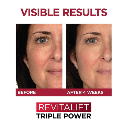 L'Oréal Paris Revitalift Triple Power Anti-Aging Face Moisturizer, Pro Retinol, Hyaluronic Acid & Vitamin C, Reduce Wrinkles 2.55 Oz Beauty Revitalift-Triple-Power-Anti-Aging-Face-Moisturizer-Pro-Retinol-Hyaluronic-Acid-Vitamin-C-Reduce-Wrinkles-2-55-Oz-EXprimi-Skincare-Kenya-3896 shop at Exprimi Beauty Kenya. Home of Skin care, Body care, Make-up, Fragrance & Beauty.